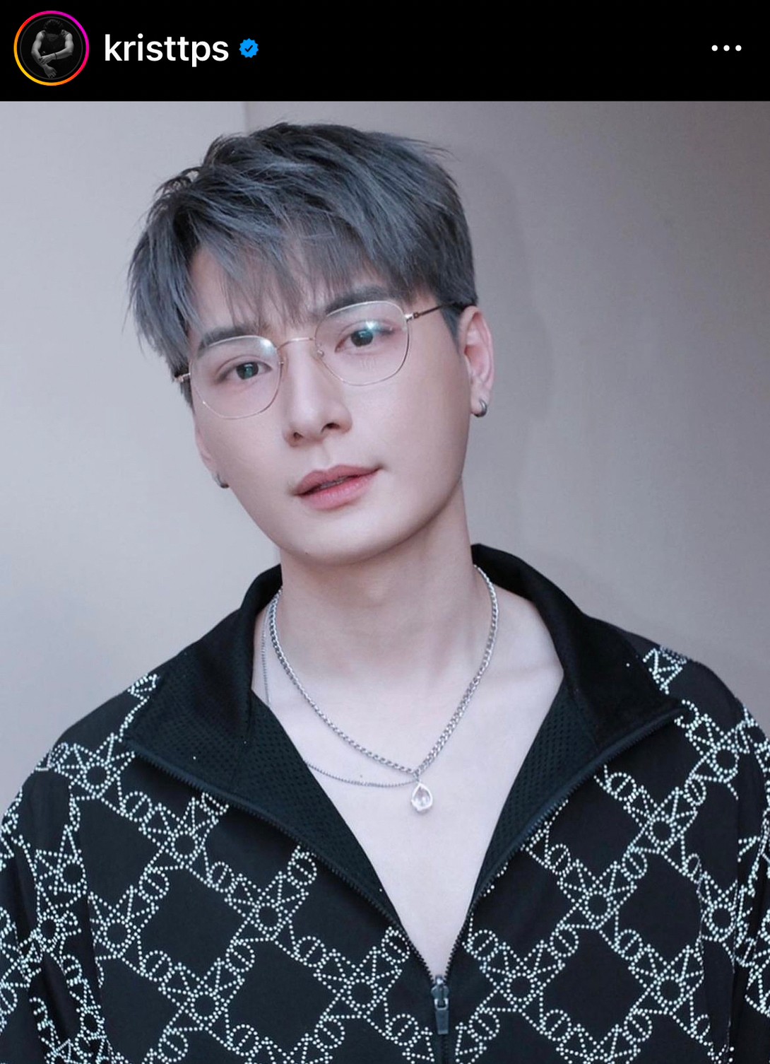 คริส พีรวัส อัปเดตโรคตาแห้ง ต้องรักษาตลอดชีวิต เผยสาเหตุยุติเส้นทางคู่จิ้น สิงโต คริส พีรวัส อัปเดตโรคตาแห้ง ต้องรักษาตลอดชีวิต เผยสาเหตุยุติเส้นทางคู่จิ้น สิงโต
