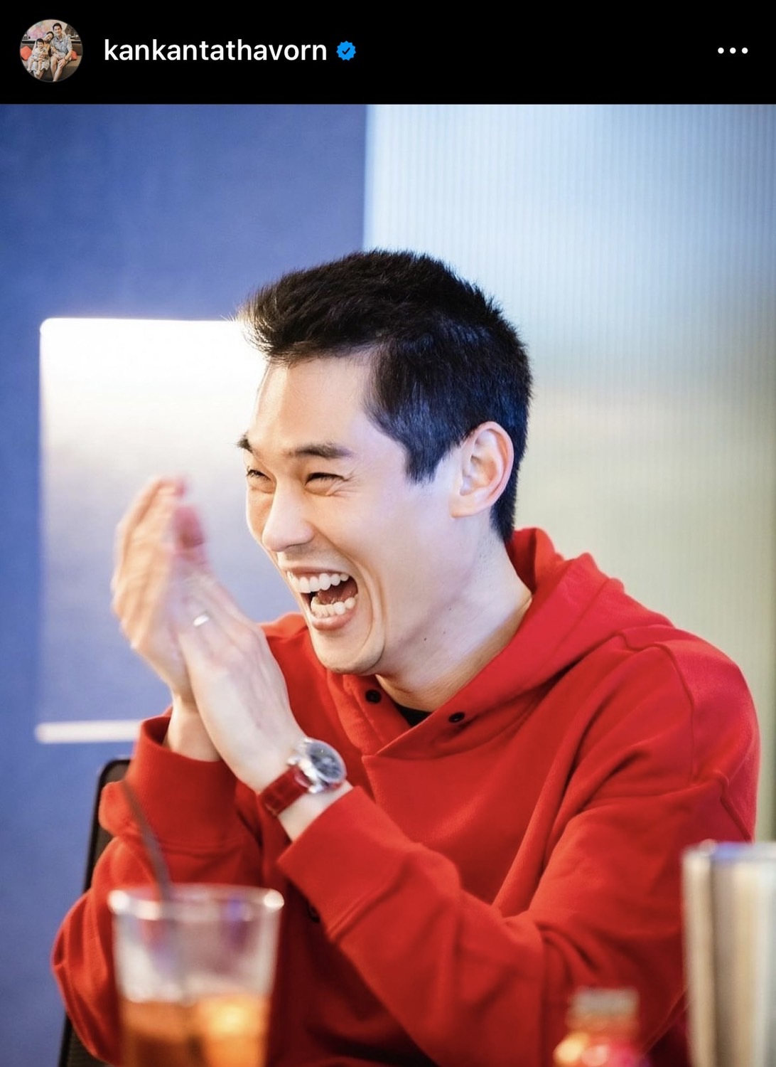 ไม่ต้องตกใจ กันต์ กันตถาวร ภาพรอยช้ำที่แขน ยันไม่ได้ทะเลาะกับเมีย