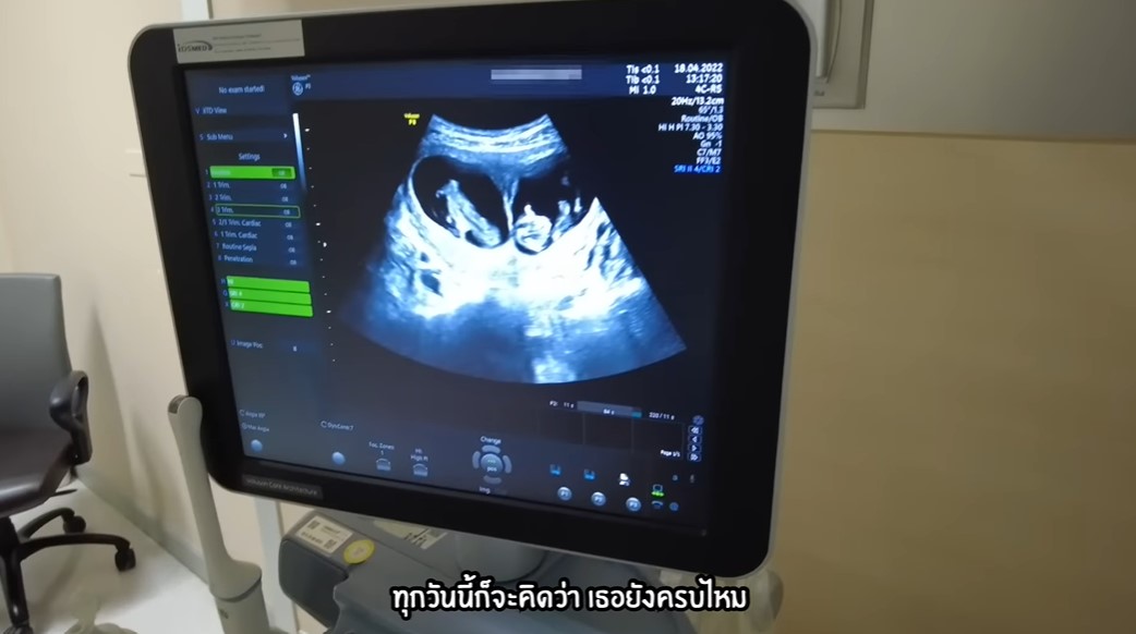 เปิดใจ บีม กวี ว่าที่คุณพ่อลูก 4 ยลโฉมเบบี๋ฝาแฝดท้อง 2 เผย ภรรยา แพ้ท้องหนัก