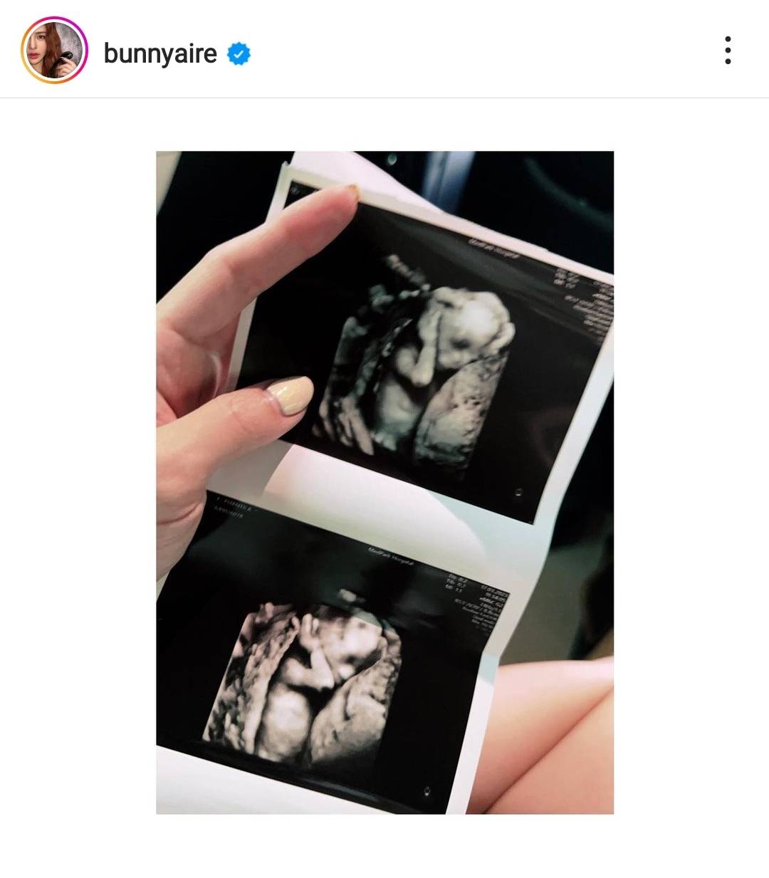 แอร์ ภัณฑิลา ประกาศข่าวดี ท้องลูกคนแรกแล้ว แอร์ ภัณฑิลา ประกาศข่าวดี ท้องลูกคนแรกแล้ว