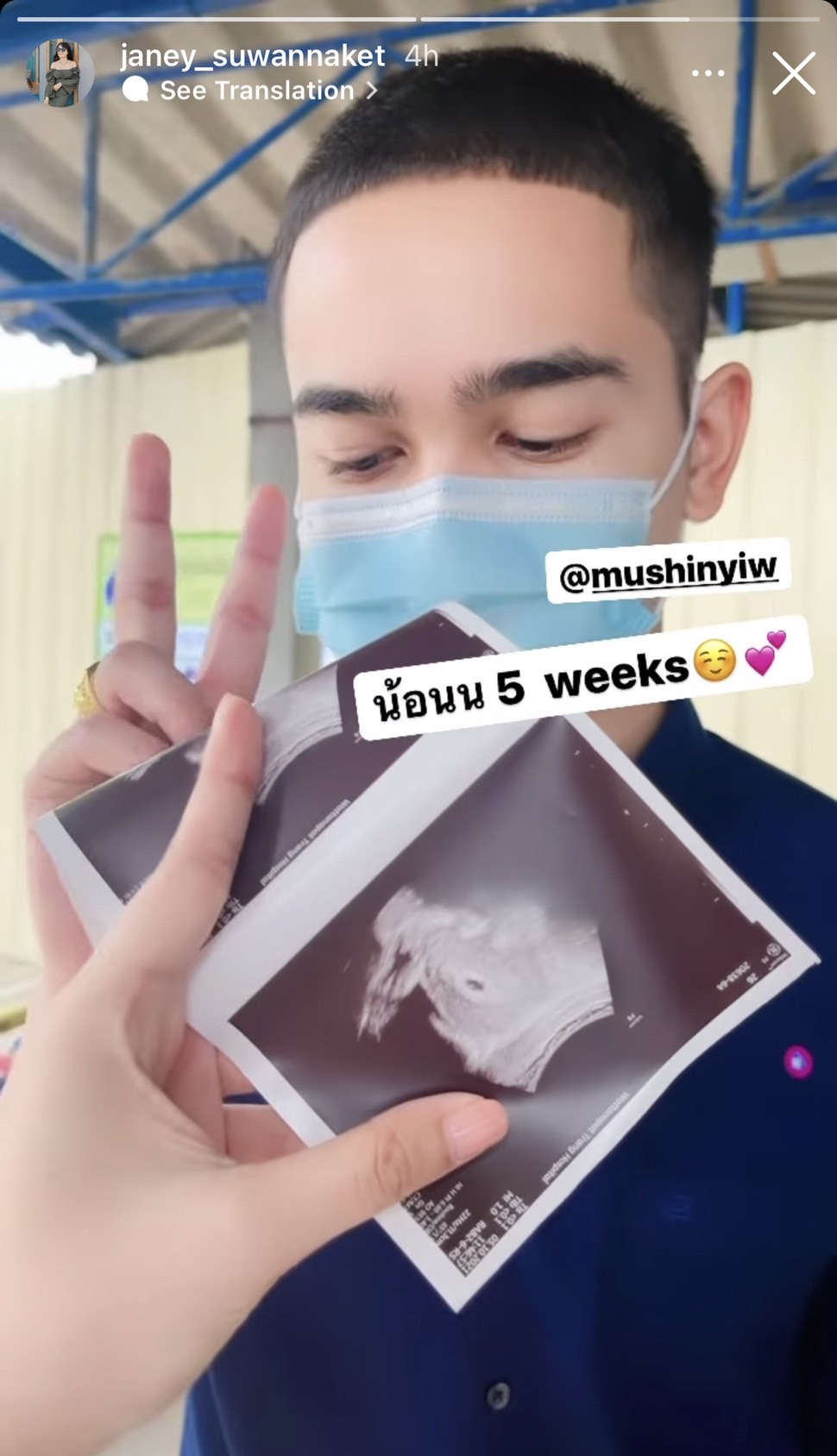 เจนนี่ รัชนก เผยภาพอัลตร้าซาวด์ลูกคนแรก