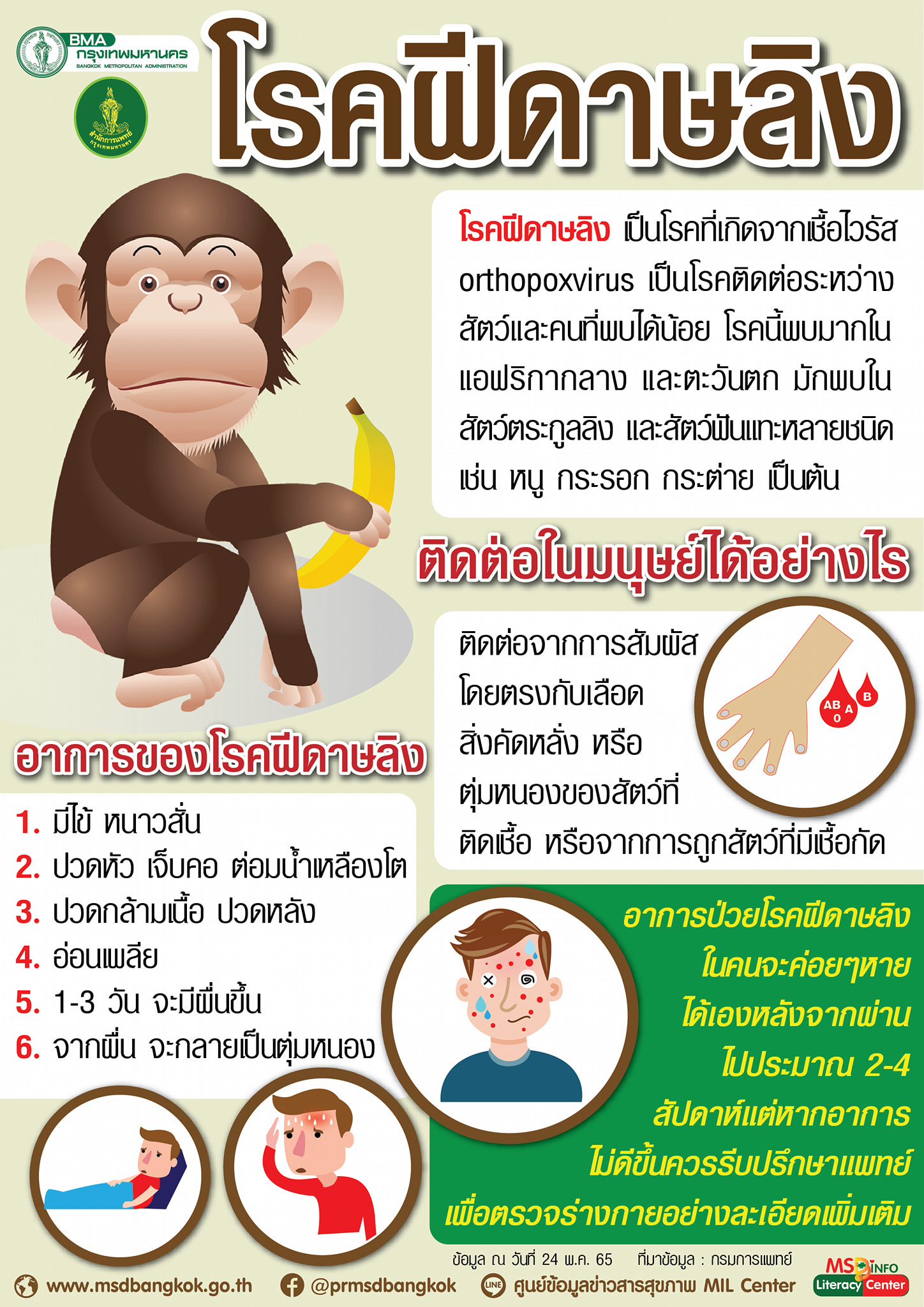 โรคฝีดาษลิง ลักษณะอาการของโรคเป็นอย่างไร? พร้อมแนะวิธีป้องกัน โรคฝีดาษลิง ลักษณะอาการของโรคเป็นอย่างไร? พร้อมแนะวิธีป้องกัน