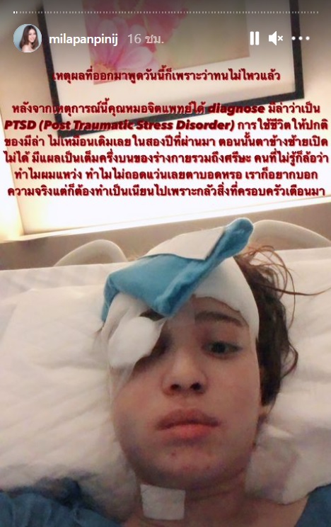 เรื่องราวสุดช็อก! 'มีล่า' อดีตนักร้องดัง ถูกน้องชายแท้ๆ ทำร้ายจนบาดเจ็บสาหัส