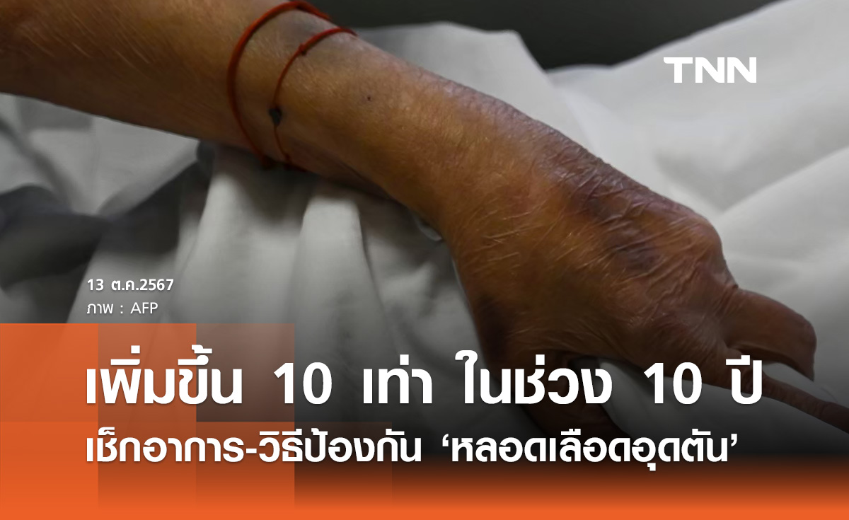 หลอดเลือดอุดตัน! ไทยพบผู้ป่วยเพิ่ม 10 เท่า เช็กอาการ-วิธีป้องกันได้ที่นี่