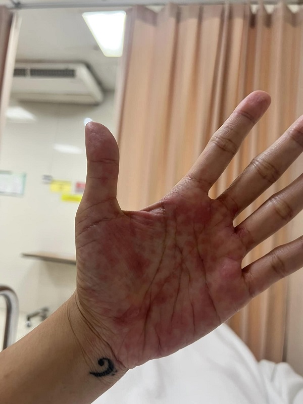 หมิว สิริลภัส ถูกหามส่งโรงพยาบาล หลังแพ้ยาหนัก (มีคลิป)