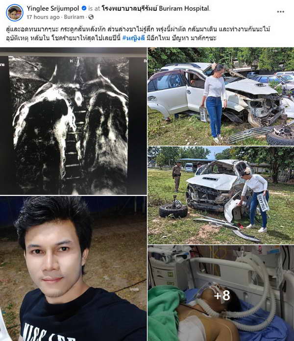 หญิงลี ศรีจุมพล น้ำตาคลออัปเดตอาการแฟนหนุ่ม รถคว่ำ กระดูกสันหลังหัก ไร้ความรู้สึกครึ่งตัว หญิงลี ศรีจุมพล น้ำตาคลออัปเดตอาการแฟนหนุ่ม รถคว่ำ กระดูกสันหลังหัก ไร้ความรู้สึกครึ่งตัว