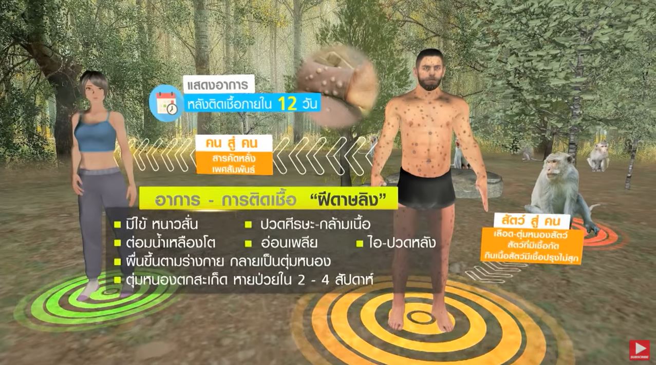 เปิดจุดเริ่มต้น ฝีดาษลิง จากอังกฤษ