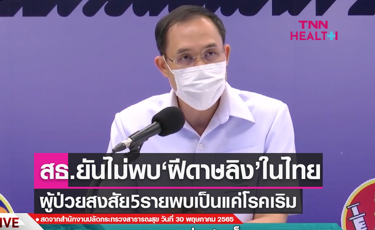 ยืนยันไทยยังไม่พบผู้ป่วยโรคฝีดาษลิง ติดตาม 12 รายใกล้ชิดกับผู้ป่วยที่ต่อเครื่อง ยังปลอดภัย