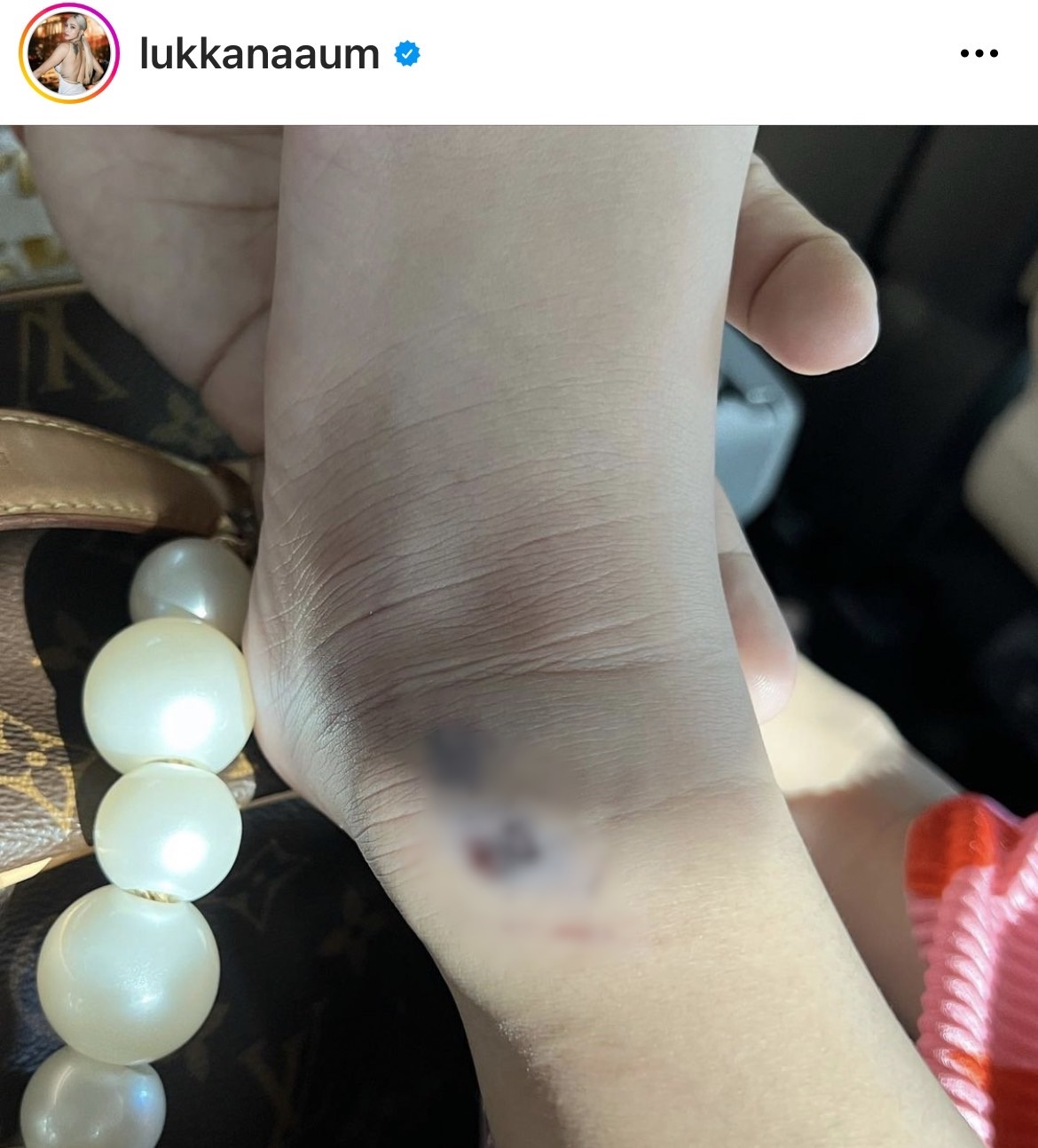 อุ้ม ลักขณา เล่าเหตุการณ์ น้องดิสนีย์ เกิดอุบัติเหตุ ลั่น! ปวดใจและอยากเจ็บแทน...