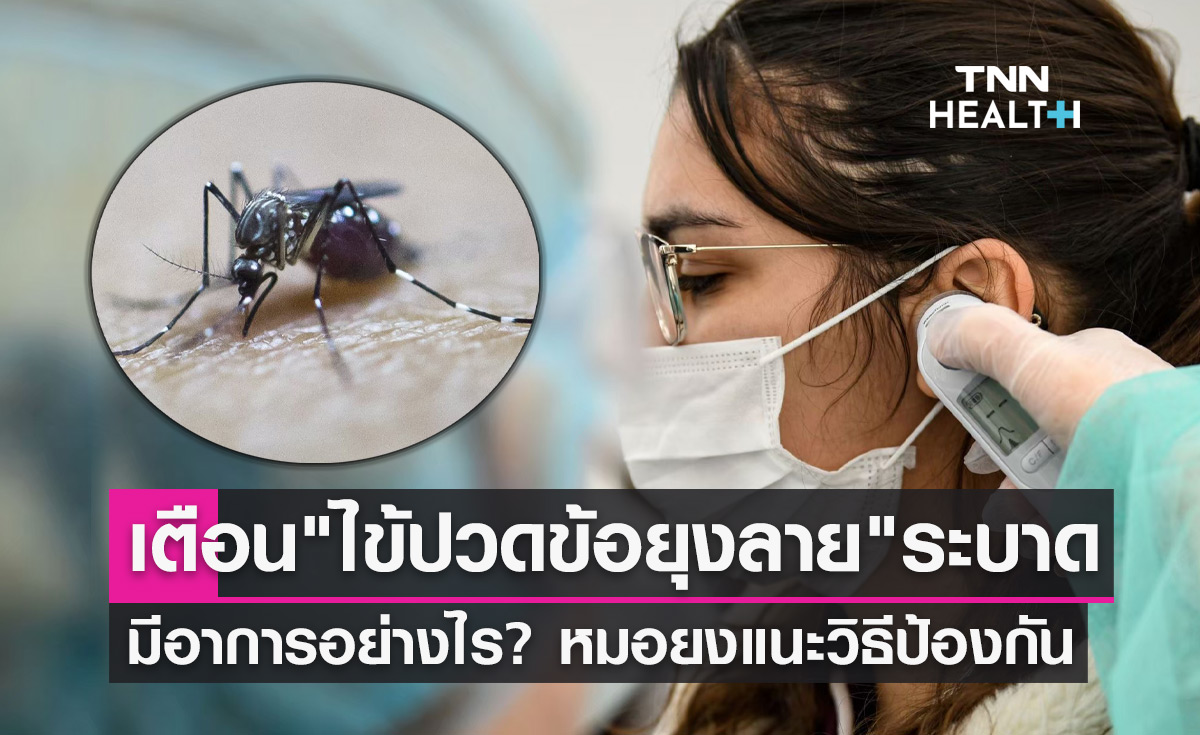เตือน! "ไข้ปวดข้อยุงลาย" ระบาด มีอาการอย่างไรเช็กเลยที่นี่