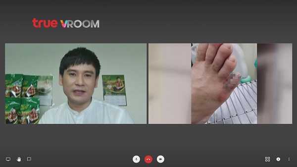 ไผ่ พงศธร อัปเดตนิ้วเท้าหายเป็นปกติ พร้อมลุยงานแล้ว   (มีคลิป)
