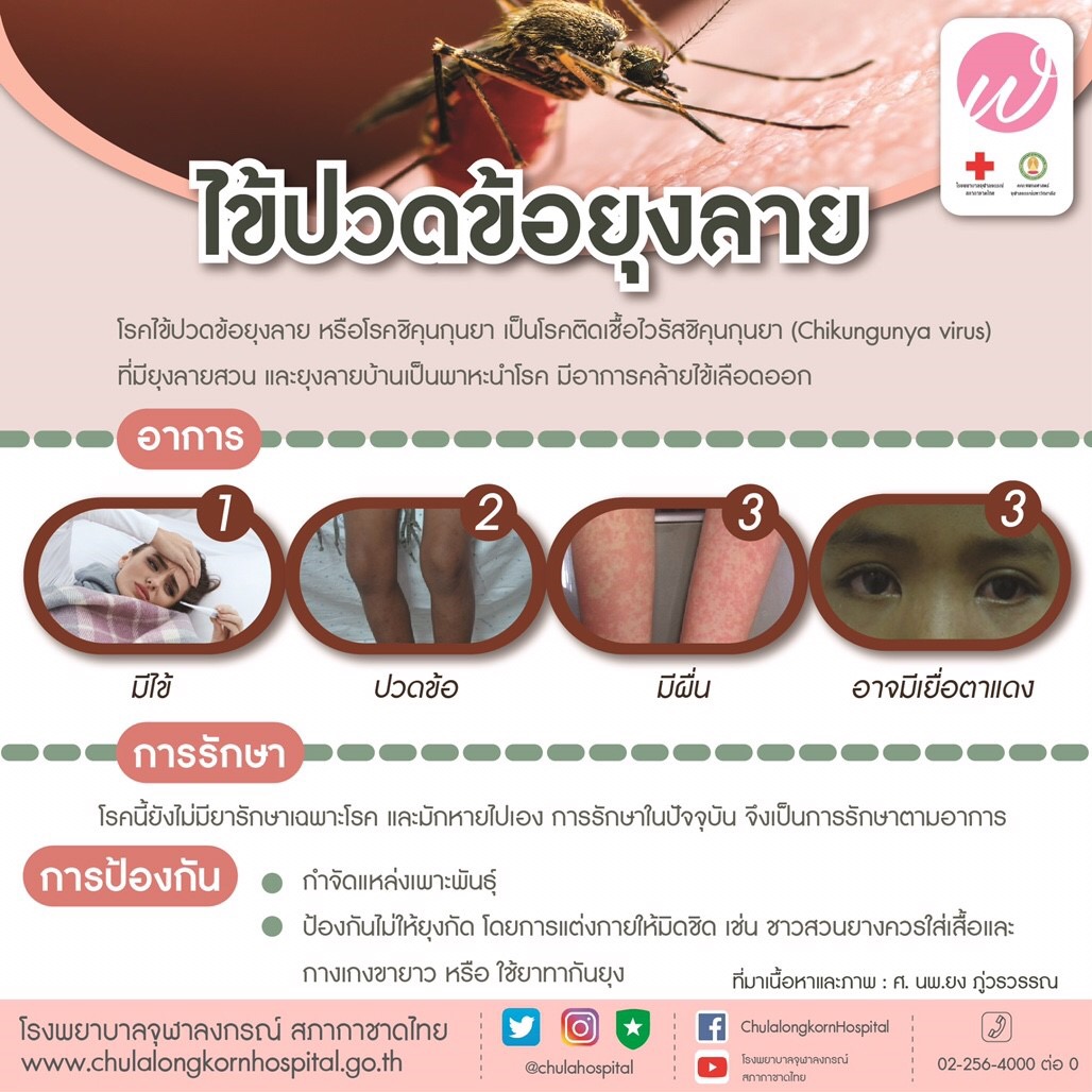 เตือน! ไข้ปวดข้อยุงลาย ระบาด มีอาการอย่างไรเช็กเลยที่นี่