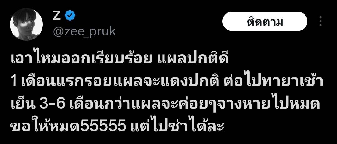 ตัดไหมแล้ว ซี พฤกษ์ อัปเดตอาการหลังประสบอุบัติเหตุจนต้องเย็บถึง 8 เข็ม