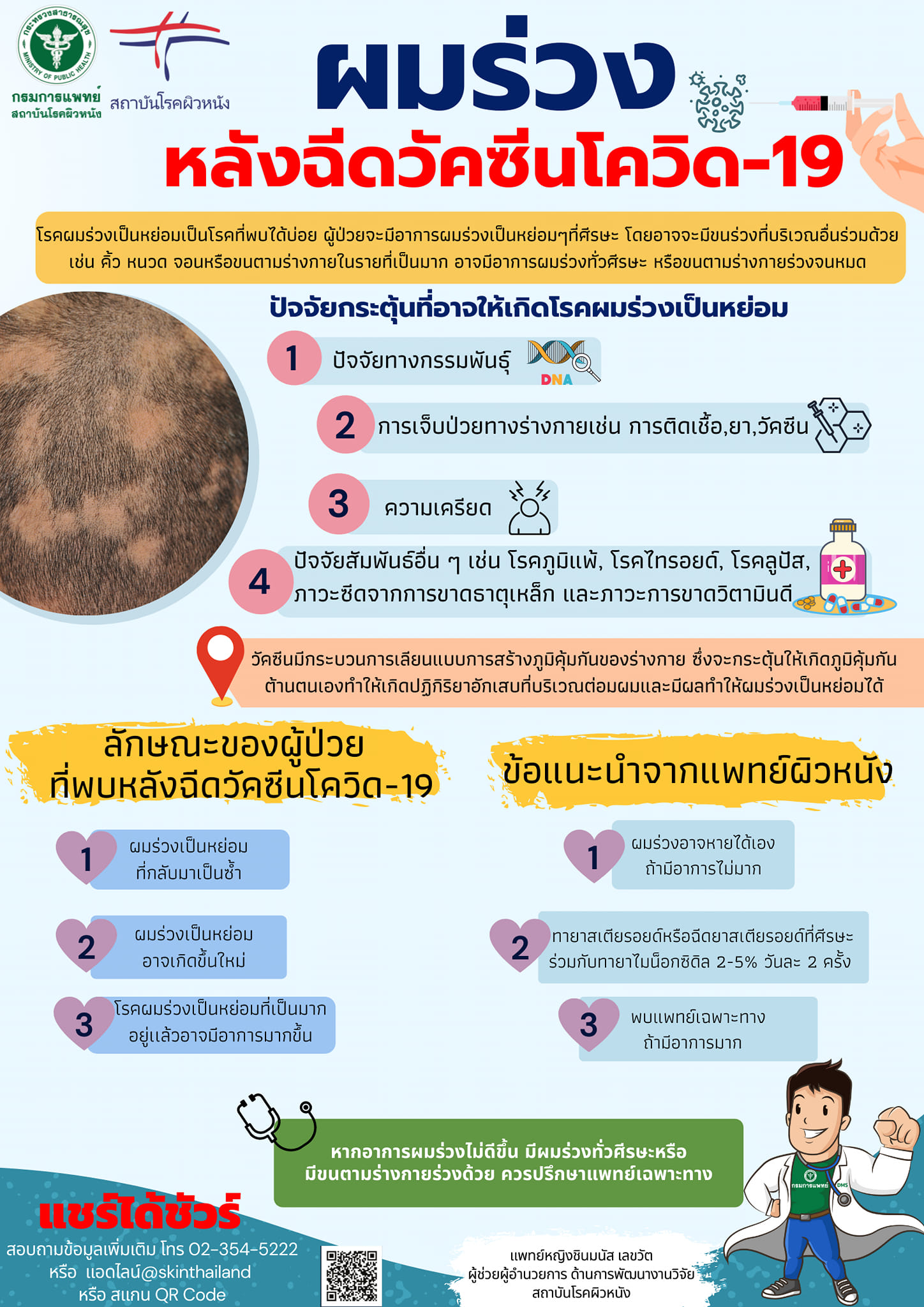 ภาวะผมร่วงเป็นหย่อม สามารถเกิดขึ้นได้หลังฉีดวัคซีนโควิด 
