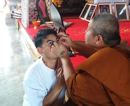 แพทย์ เตือน ฝังตะกรุดทอง สาริกาตาหวาน เสี่ยงตาบอด