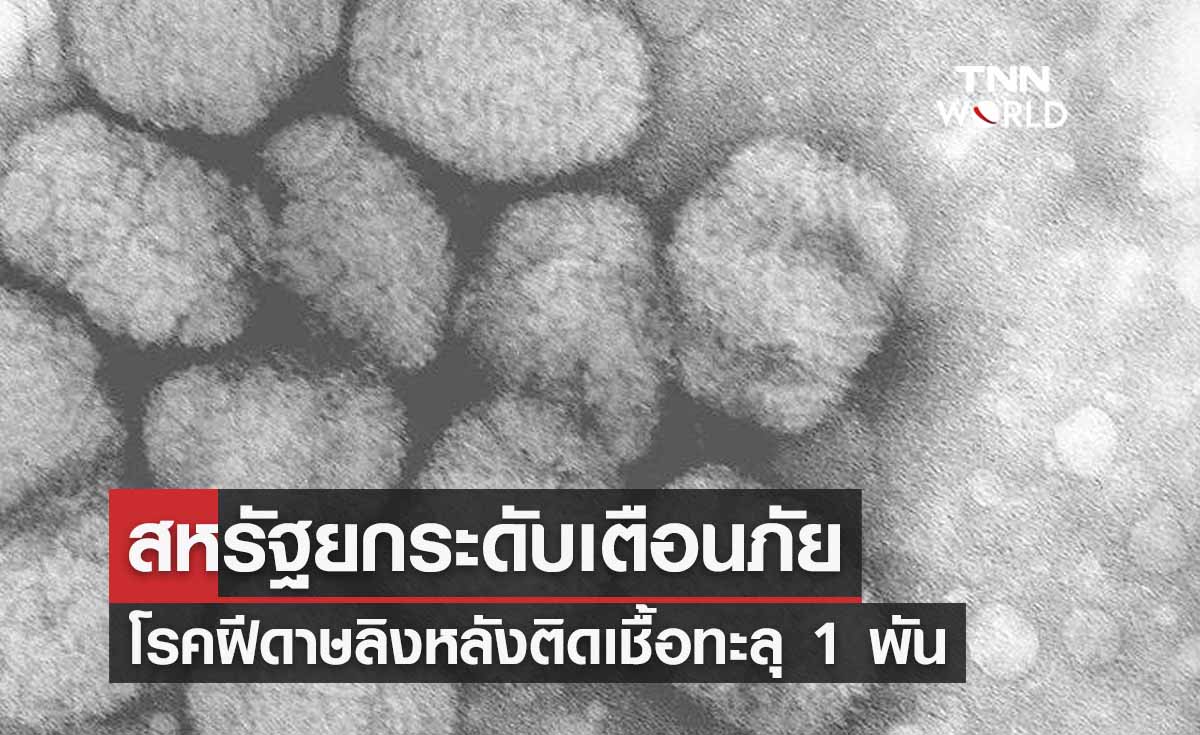 สหรัฐยกระดับเตือนภัยฝีดาษลิง หลังติดเชื้อทะลุ 1 พันราย 