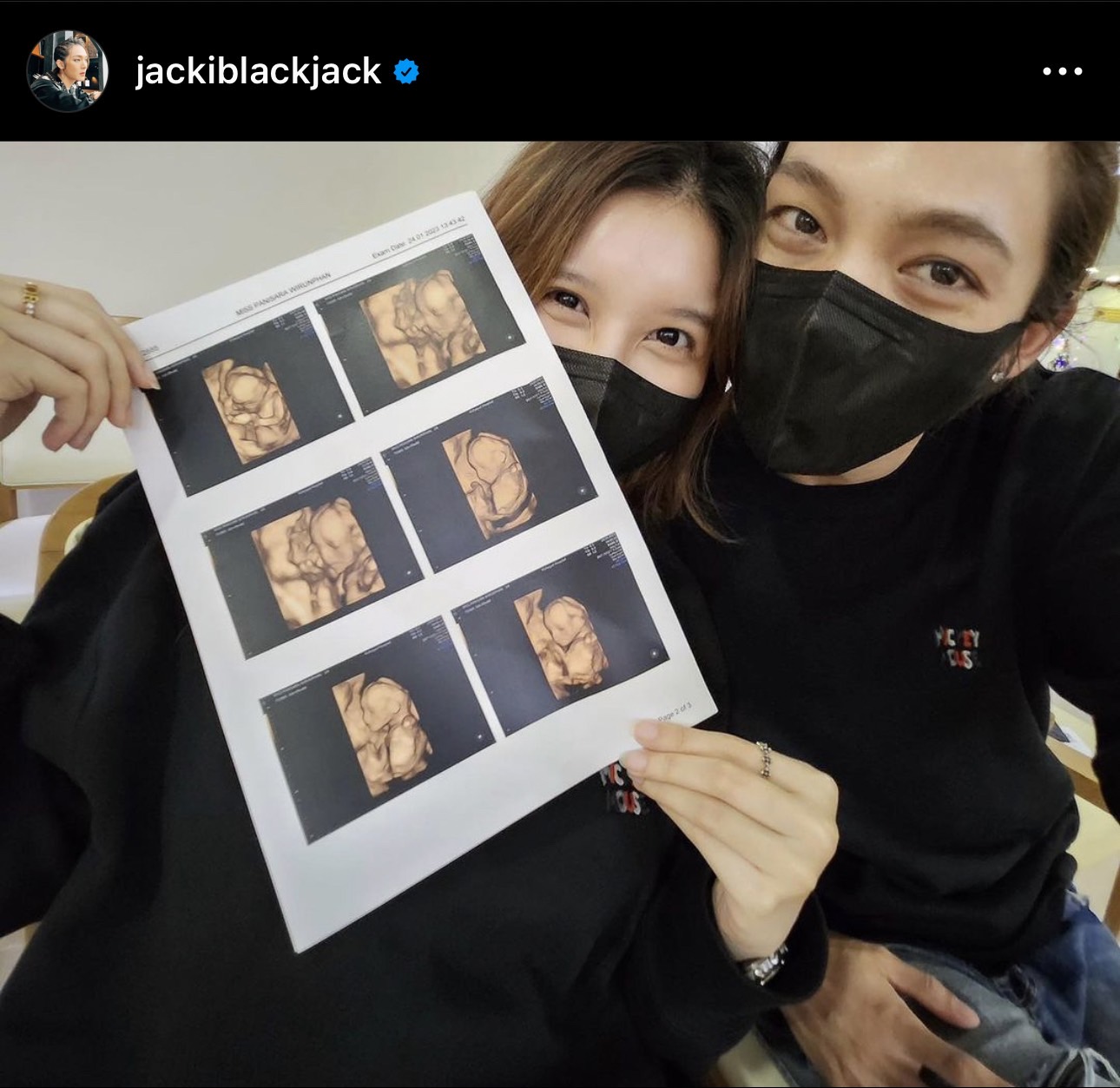 แจ็ค แบล็คแจ็ค รับห่วงความรู้สึกอีกฝ่าย หลังเสียบแทน พระเอกดังชักกลางกลอง แจ็ค แบล็คแจ็ค รับห่วงความรู้สึกอีกฝ่าย หลังเสียบแทน พระเอกดังชักกลางกลอง