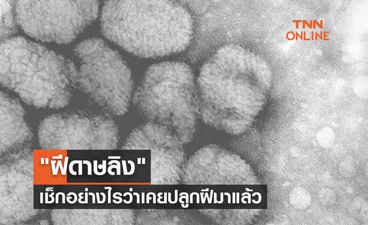 "ฝีดาษลิง" เช็กหลักสังเกตอย่างไรว่าเคยปลูกฝีมาแล้วหรือไม่?
