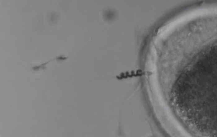 สเปิร์มบอต (Spermbot) รถแท็กซี่ของตัวอสุจิ ช่วยแก้ปัญหาภาวะเป็นหมันจากตัวอสุจิเคลื่อนไหวน้อย สเปิร์มบอต (Spermbot) รถแท็กซี่ของตัวอสุจิ ช่วยแก้ปัญหาภาวะเป็นหมันจากตัวอสุจิเคลื่อนไหวน้อย
