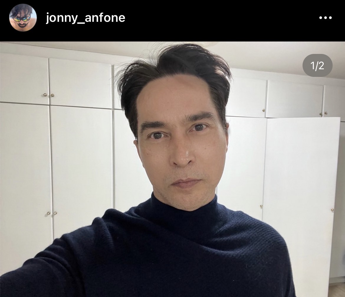 จอนนี่ แอนโฟเน ถอนฟ้อง! ไม่เรียกเงิน 50 ล้าน กรณีเข้าใจผิดนำภาพไปใช้ 