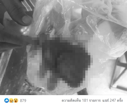 สาวช็อก! เจอผ้าก๊อซก้อนใหญ่ในช่องคลอด ติดมานาน 2 เดือน สาวช็อก! เจอผ้าก๊อซก้อนใหญ่ในช่องคลอด ติดมานาน 2 เดือน