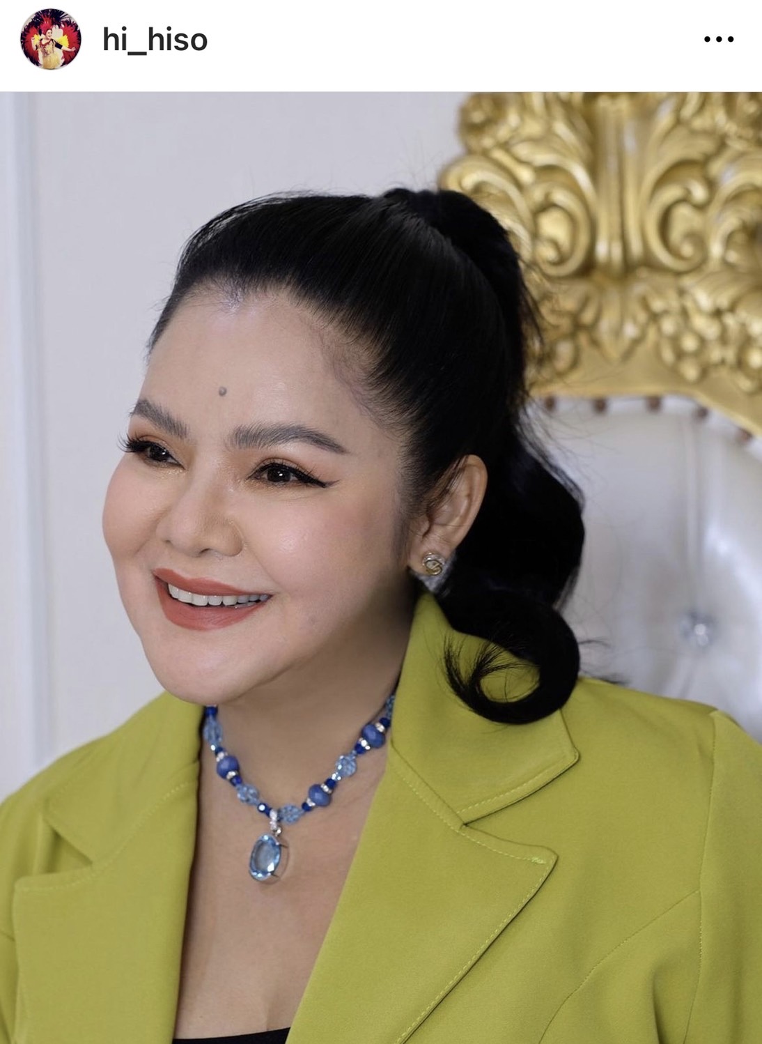 “ฮาย อาภาพร” ทำบุญหนักพักผ่อนน้อย จนมีปัญหาดวงตา