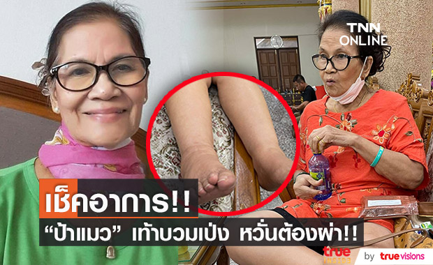 "ป้าแมว ดาวพระศุกร์" เตรียมเข้าอุโมงค์ฉีดสี หลังมีอาการเท้าบวม!!