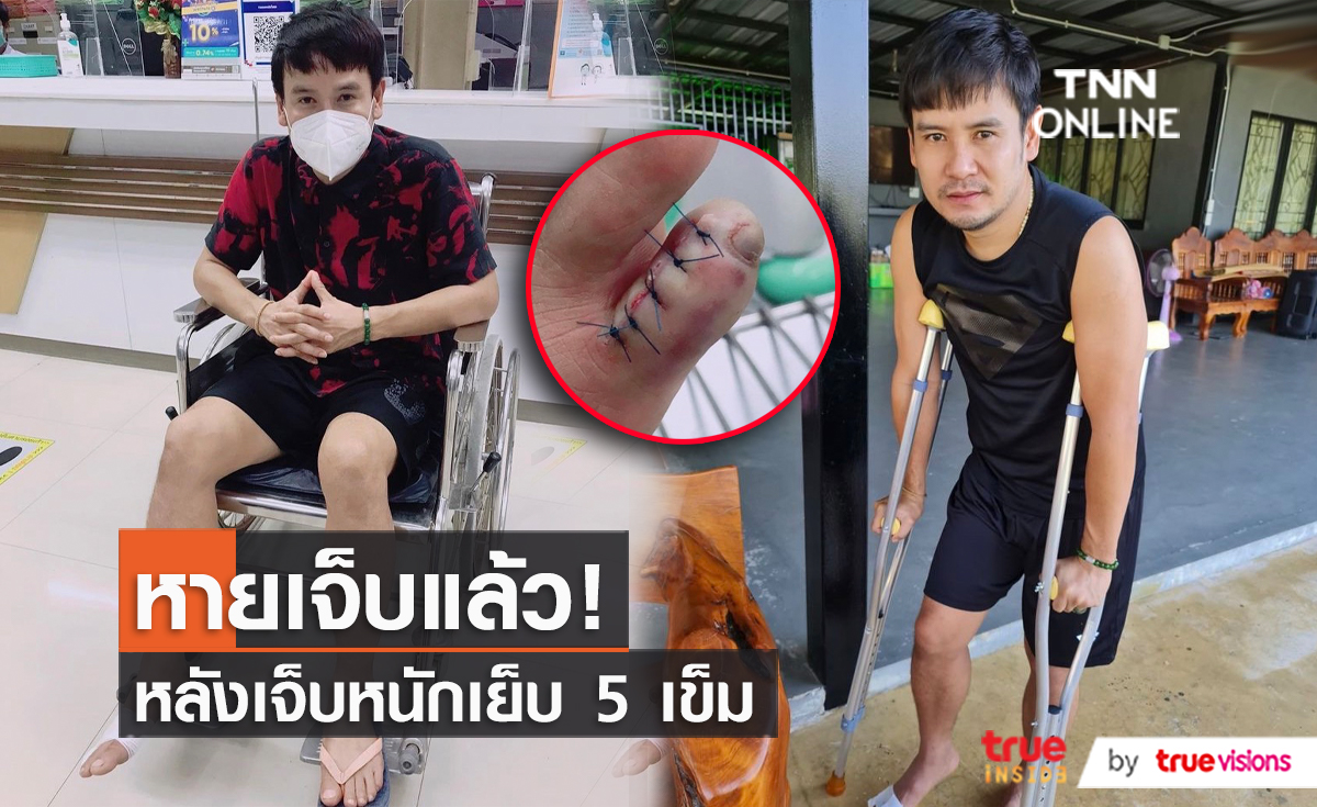 "ไผ่ พงศธร" นิ้วเท้าหายเป็นปกติ พร้อมลุยงานแล้ว  (มีคลิป)