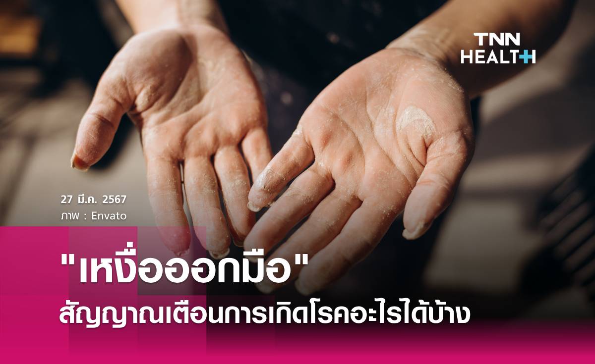 "เหงื่อออกมือ" สัญญาณเตือนการเกิดโรคอะไรได้บ้าง