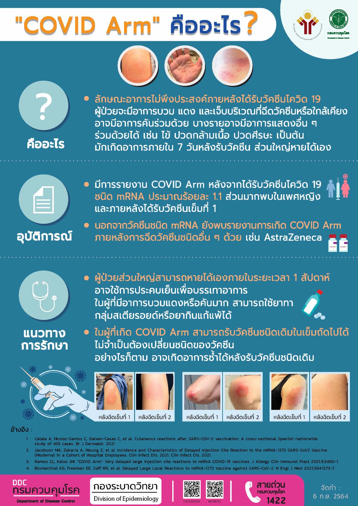รู้จัก COVID Arm อาการไม่พึงประสงค์หลังฉีดวัคซีนโควิดชนิด mRNA
