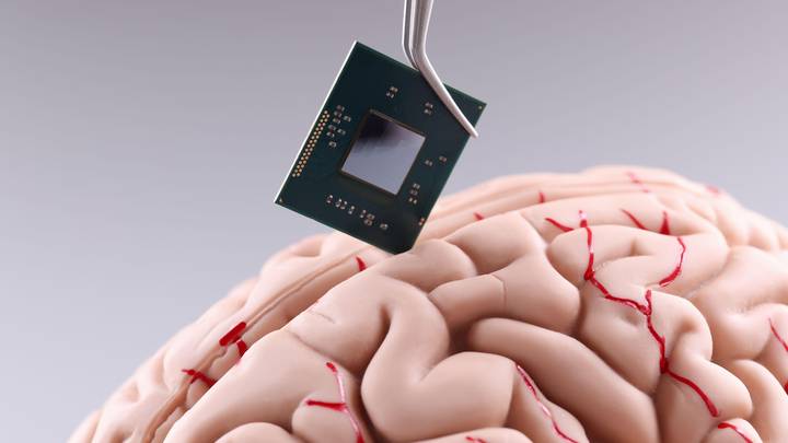 อัปเกรดสมอง วิวัฒนาการขั้นสุดยอดของมวลมนุษย์ ด้วยชิป Neuralink