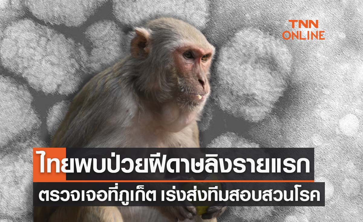 รายแรกของไทย! พบผู้ป่วยโรคฝีดาษลิงที่ภูเก็ต เร่งสอบสวนโรค