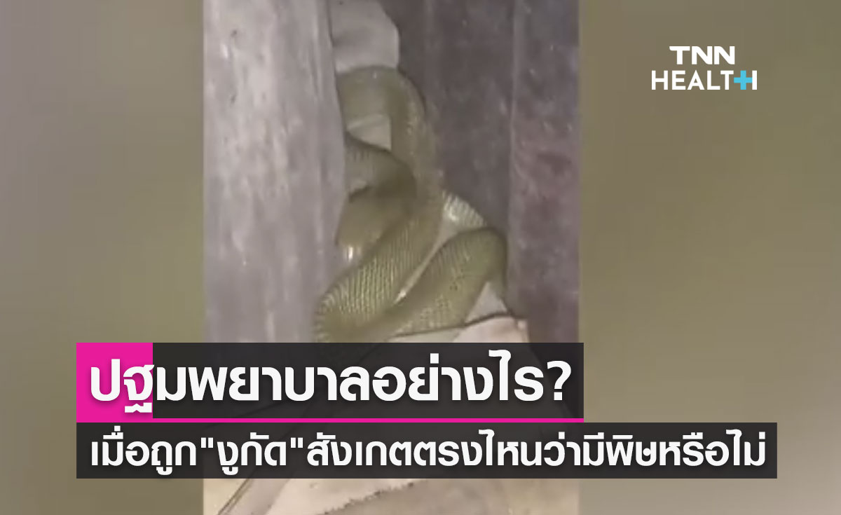 ปฐมพยาบาลอย่างไร? เมื่อถูก "งูกัด" สังเกตตรงไหนว่ามีพิษหรือไม่