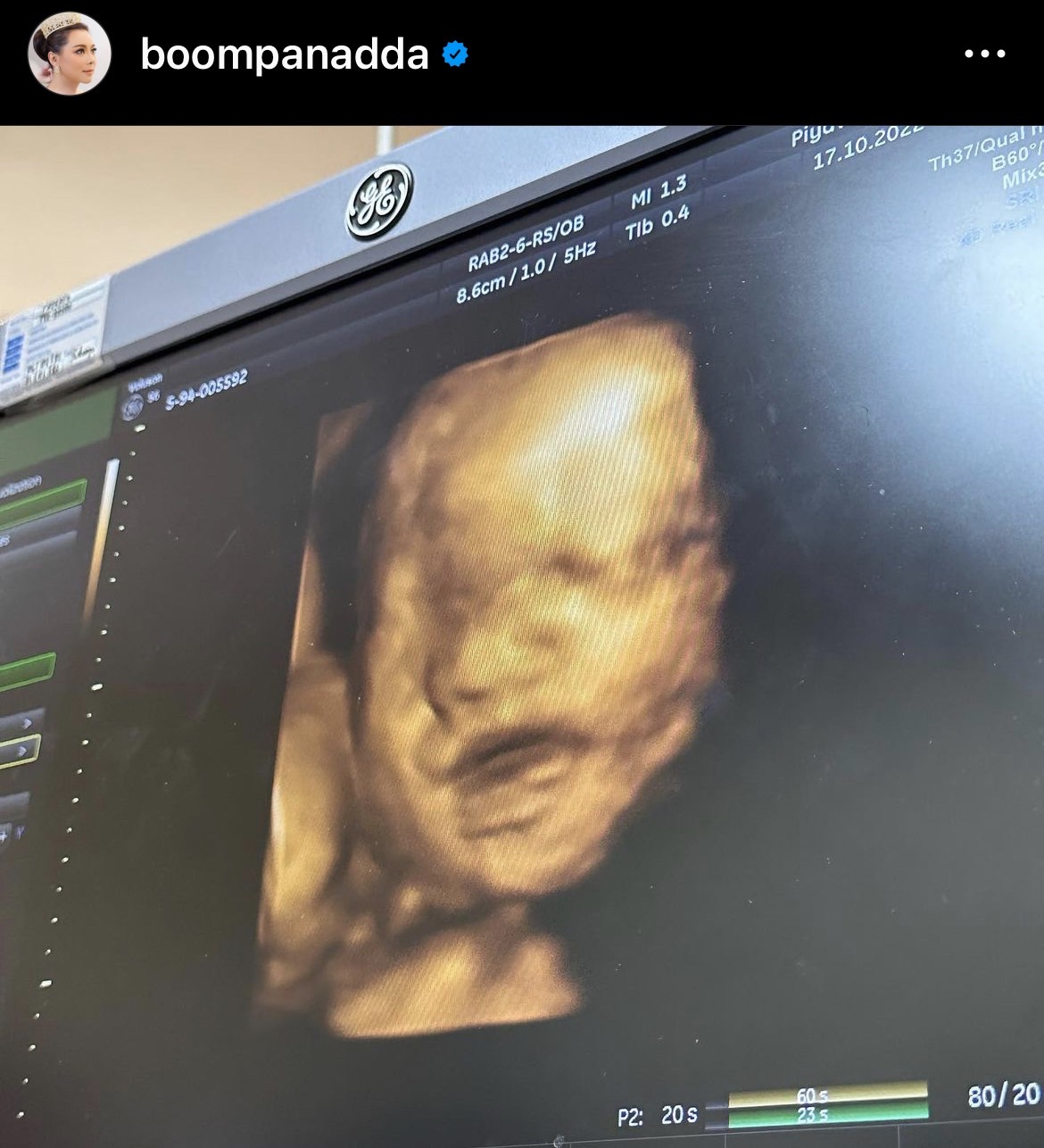 บุ๋ม ปนัดดา เผยภาพลูกชายครั้งแรก หน้าเหมือนใคร?? บุ๋ม ปนัดดา เผยภาพลูกชายครั้งแรก หน้าเหมือนใคร??