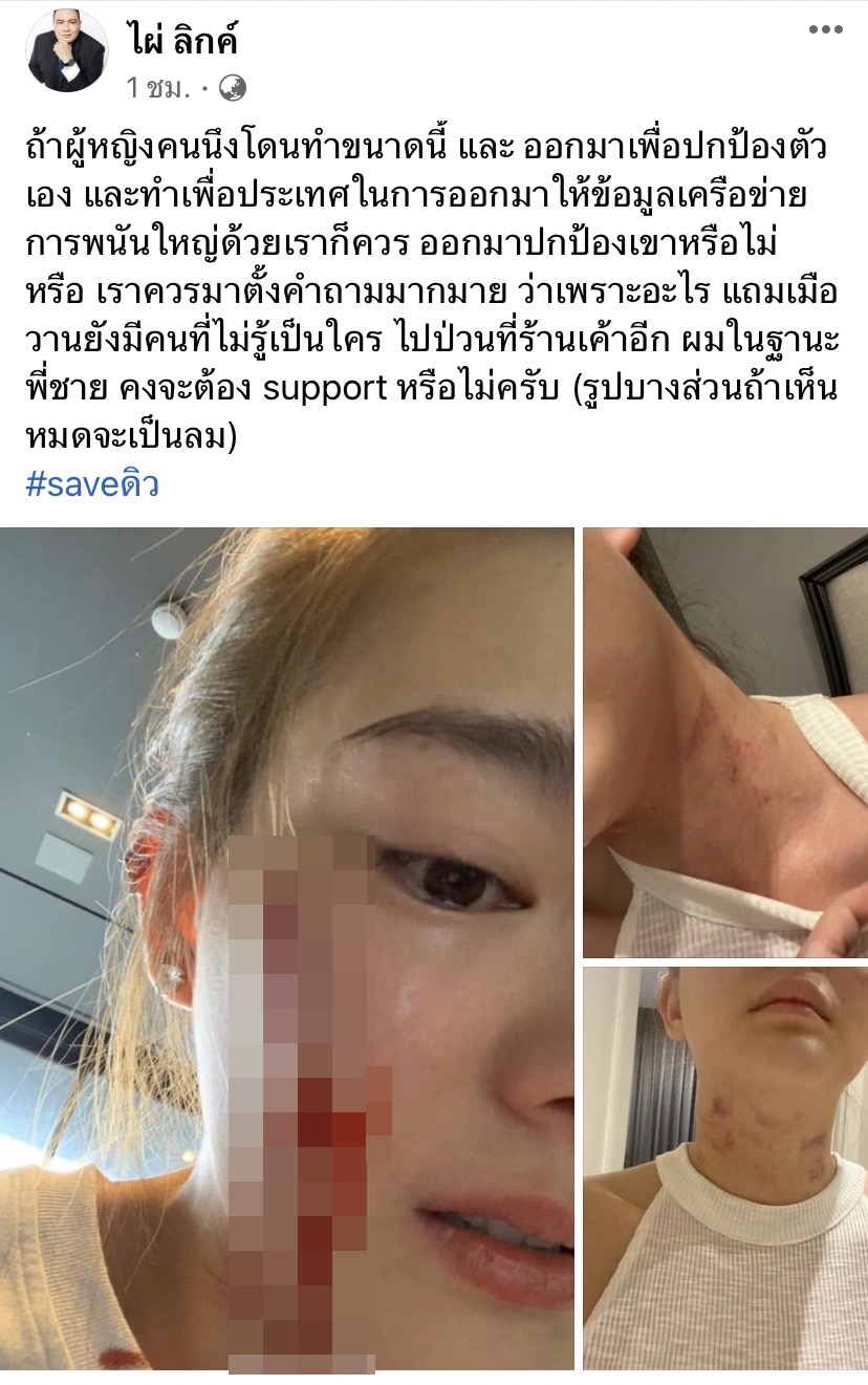 ไผ่ วันพ้อยท์ โพสต์ปกป้อง ดิว อริสรา พร้อมเผยภาพถูกทำร้ายร่างกาย