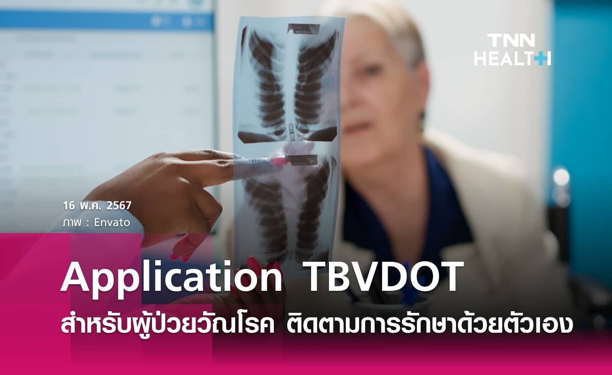 Application TBVDOT สำหรับผู้ป่วยวัณโรค ติดตามการกินยารักษาโรค ได้ด้วยตนเอง