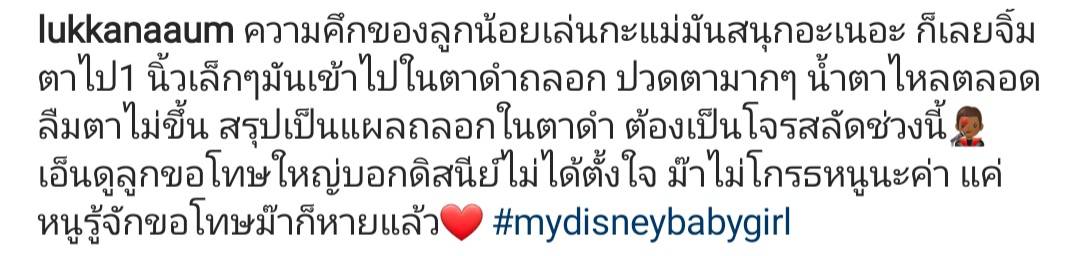 อุ้ม ลักขณา เกิดอุบัติเหตุขณะเล่นกับลูก แผลถลอกในตาดำ อุ้ม ลักขณา เกิดอุบัติเหตุขณะเล่นกับลูก แผลถลอกในตาดำ