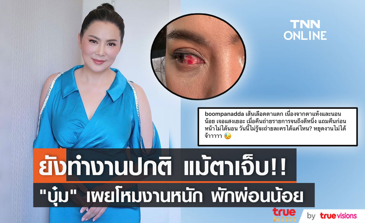 "บุ๋ม ปนัดดา" โหมงานหนักจนเส้นเลือดตาแตก
