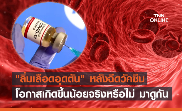 ไขข้อข้องใจ "ลิ่มเลือดอุดตัน" หลังฉีดวัคซีนโควิด โอกาสเกิดขึ้นน้อยจริงหรือ?