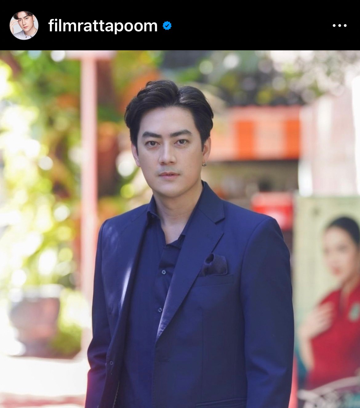 ฟิล์ม รัฐภูมิ อัปเดตผลตรวจร่างกาย หลังผ่าตัดลิ้นหัวใจรั่วครบ 3 เดือน 