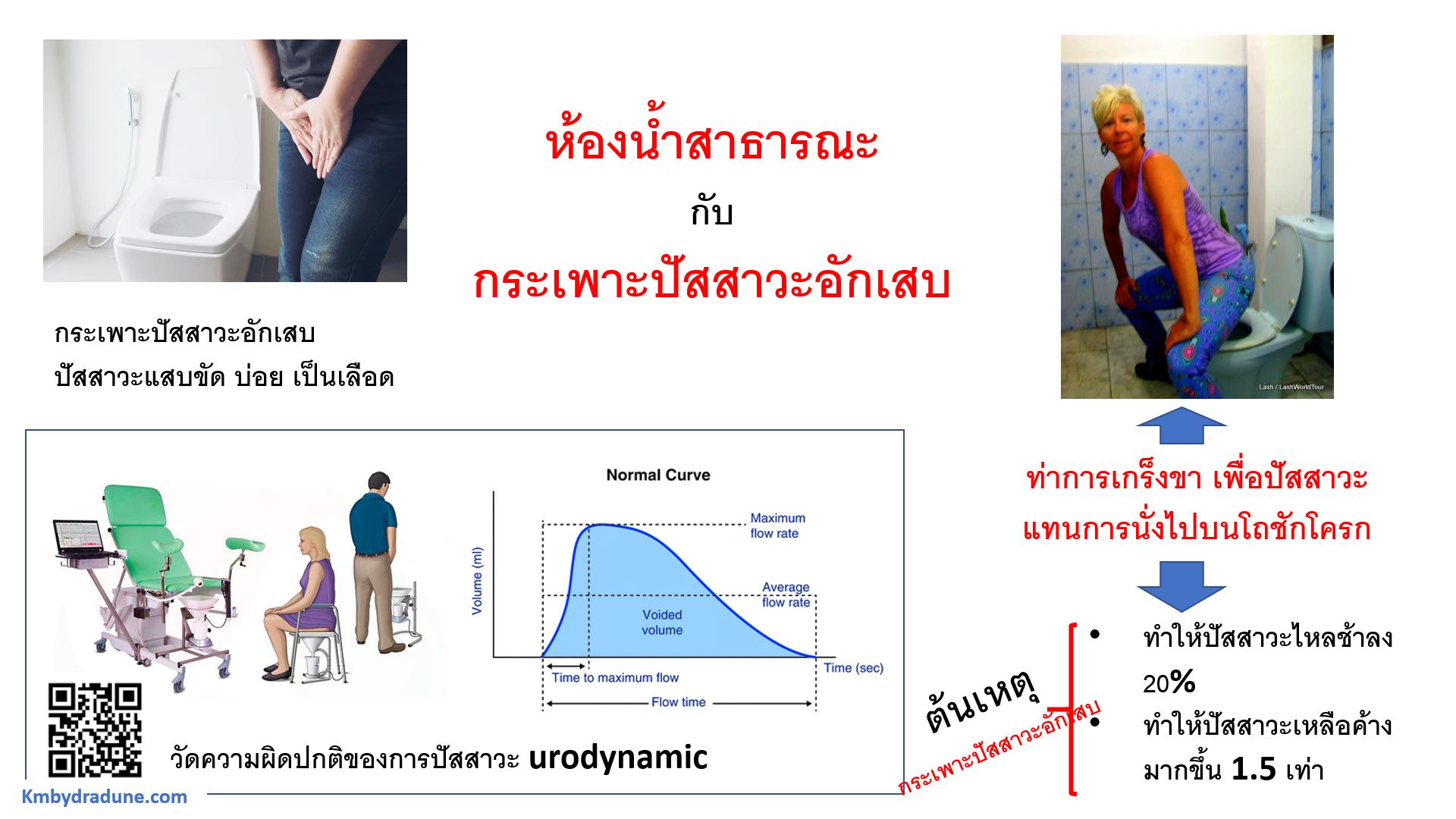 ห้องน้ำสาธารณะแล้วกระเพาะปัสสาวะอักเสบ