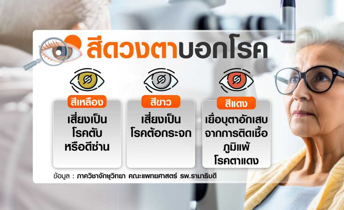 ความดันตาสูง ภัยเงียบ โรคต้อหิน แนะหมั่นสังเกตความผิดปกติ ความดันตาสูง ภัยเงียบ โรคต้อหิน แนะหมั่นสังเกตความผิดปกติ