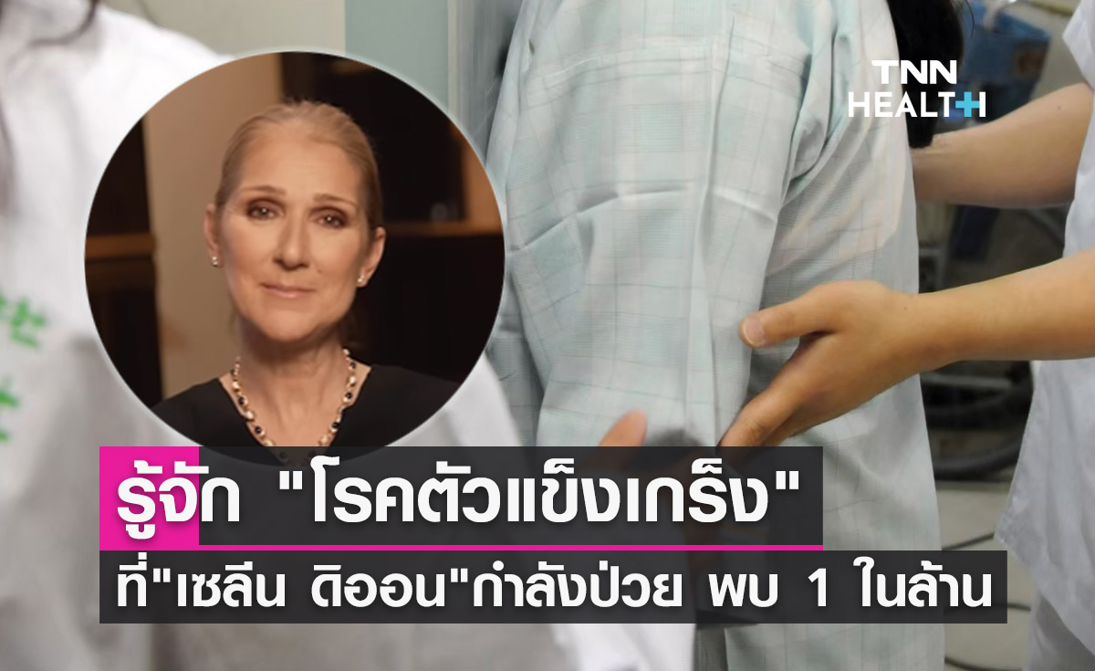 รู้จัก "โรคตัวแข็งเกร็ง" ที่ "เซลีน ดิออน" กำลังเผชิญพบเพียง 1 ในล้าน!