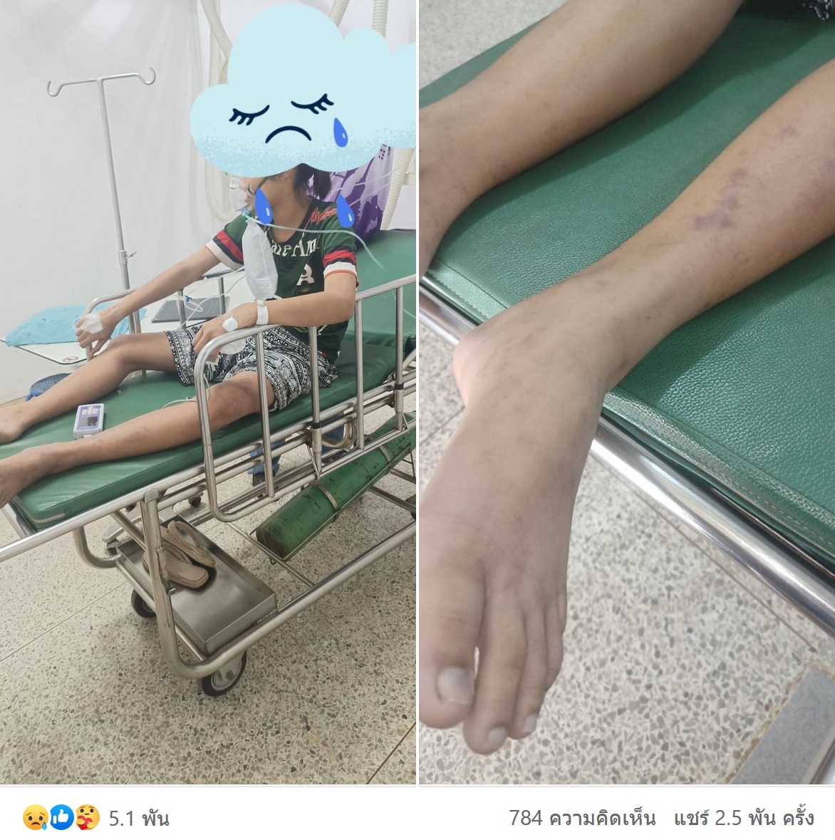 แม่โพสต์อุทาหรณ์! ลูกปวดขาหลังสอบวิชาพละ สุดท้ายเสียชีวิต