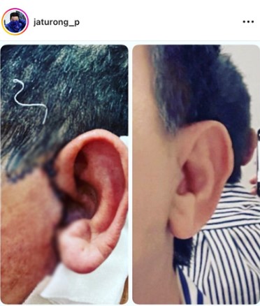 พระเอกยังอาย จาตุรงค์ มกจ๊ก อัปเดตความหล่อ หลังบินไปศัลยกรรมคอที่เกาหลี 
