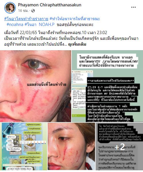 โนอา ภญมณ ว่าที่นางเอกถูกรุมทำร้ายร่างกาย
