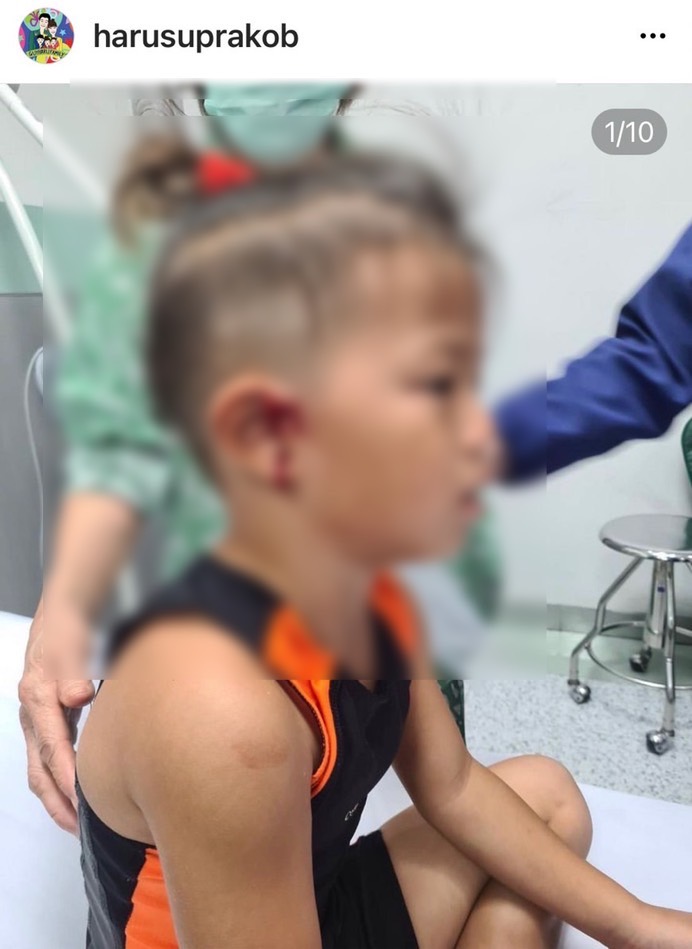 อกอีแป้นจะตาย ฮารุ โพสต์ IG ลูกชาย หลังหูกระแทกขอบเตียง