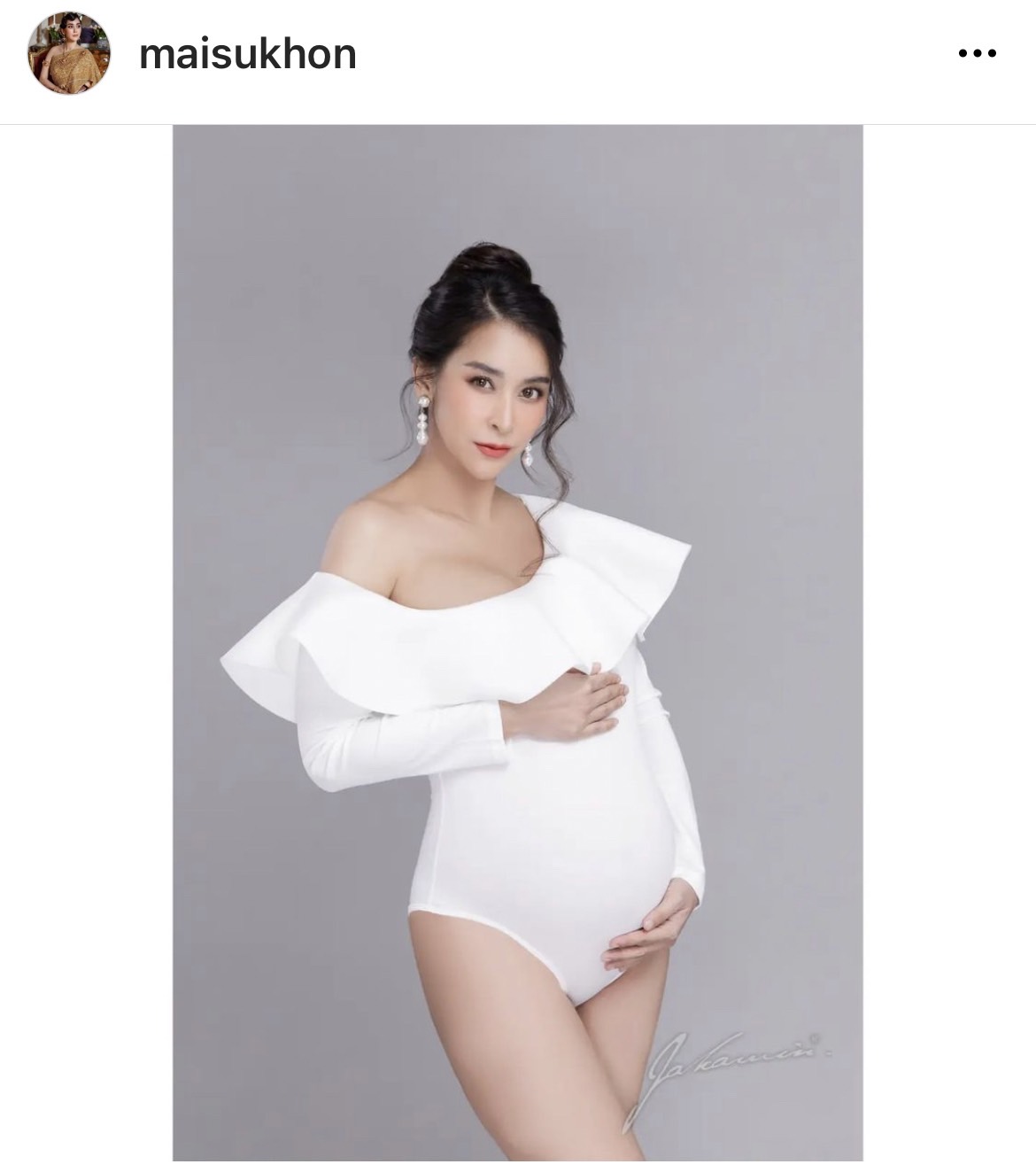 ดีเจต้น เผยลูกสาว น้องชีต้าร์ มีภาวะหัวใจเต้นผิดจังหวะ