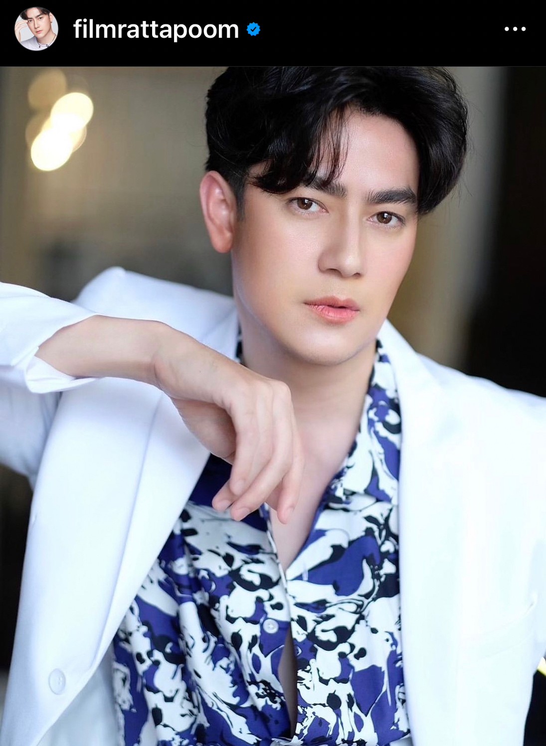 ฟิล์ม รัฐภูมิ อัปเดตผลตรวจร่างกาย หลังผ่าตัดลิ้นหัวใจรั่วครบ 3 เดือน 