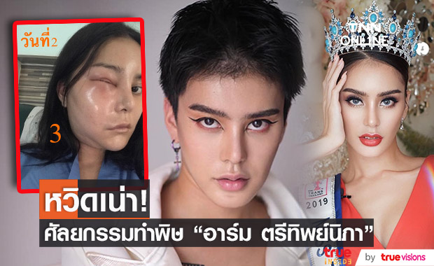 พิษศัลยกรรม! "อาร์ม" มิสทรานยูนิเวิร์สไทยแลนด์ หน้าบวมหวิดเน่า